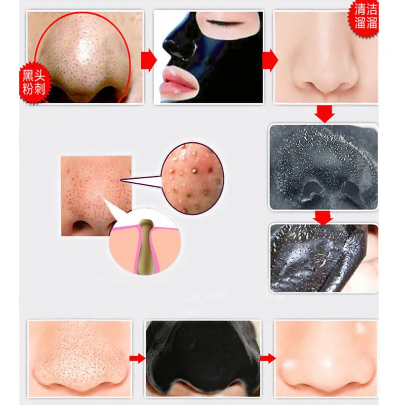 5pc Blackhead Face Mask Remover Nose Mask Deep Cleansing Acne Removal